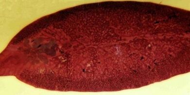 Parasitos trematodos, como eliminalos do corpo